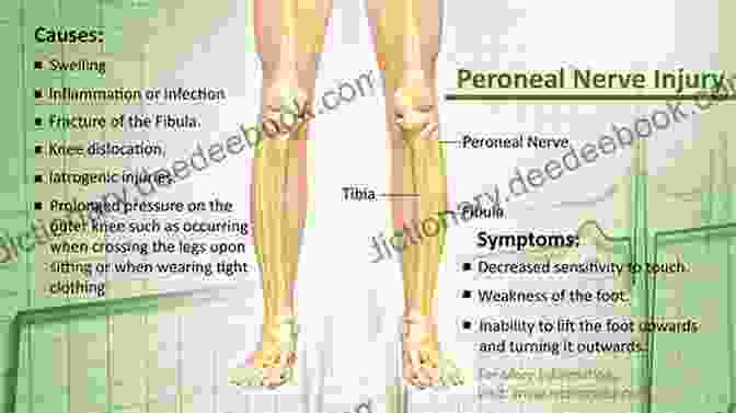 A Person With A Lumbosacral Plexus Injury Exhibiting Leg Weakness And Foot Drop. The Primal Key (The Plight Of The Plexus 1)
