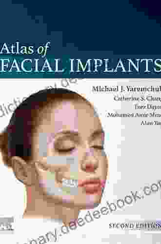 Atlas Of Facial Implants Michael J Yaremchuk